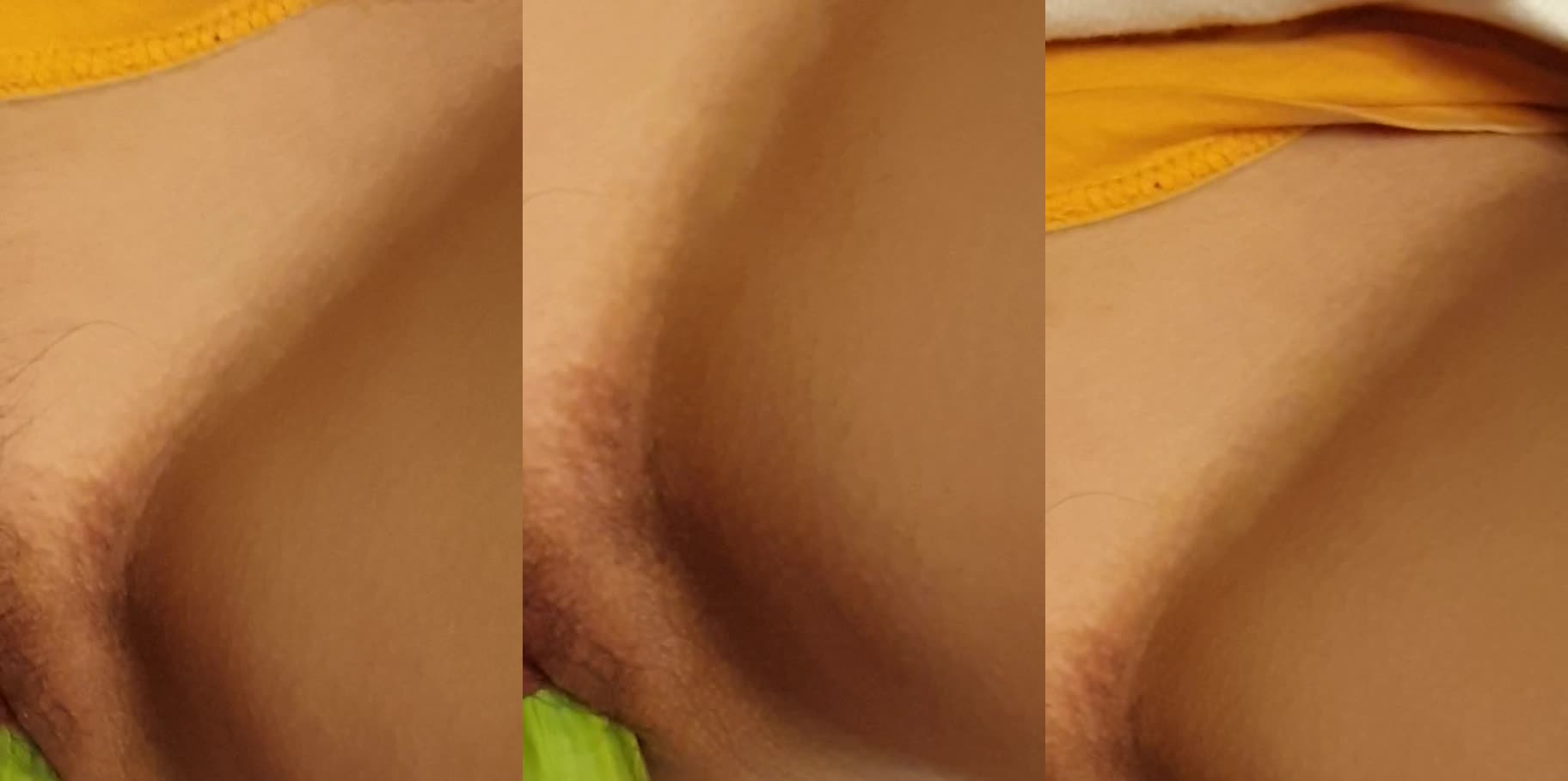 သခွားသီးကို ကွိုင်စွပ်တွယ်